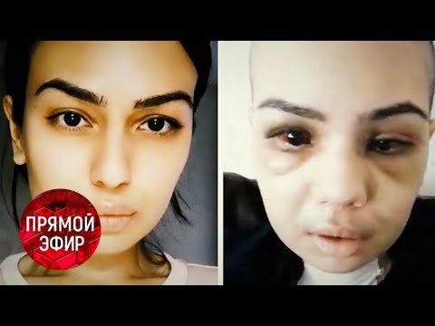 Пациентка против пластического хирурга. Андрей Малахов. Прямой эфир 14.03.19