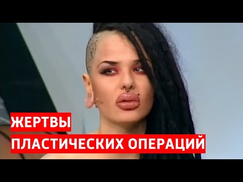 Страшно красивые. Жертвы пластической хирургии