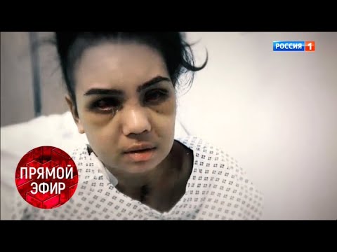 Пациентка против пластического хирурга. Андрей Малахов Прямой эфир 14.03.19