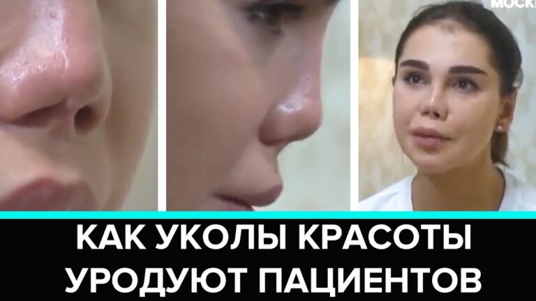 "Красивая жертва": как уколы красоты уродуют пациентов — Москва 24