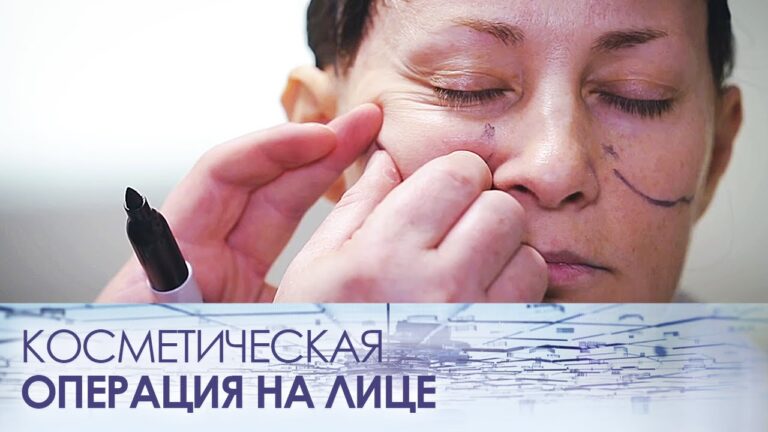 Косметическая операция на лице