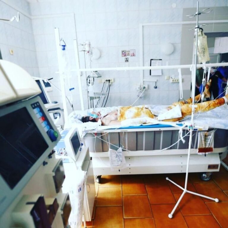 Краснодарские медики спасли приехавшего из российского города ребенка с 40% ожогов Краснодарские медики спасли приехавшего из российского города ребенка с 40% ожогов