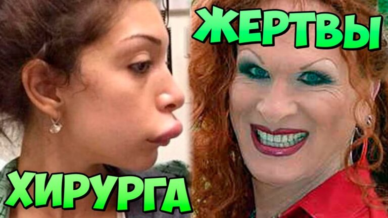 13 ШОКИРУЮЩИХ ЖЕРТВ ПЛАСТИЧЕСКОЙ ХИРУРГИИ