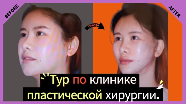 VlogKorea. Пластическая хирургия, в Южной Корее. Тур по Клинике BIO. | Vlog Korea