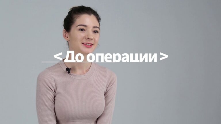 Ринопластика липофилинг отзыв Лучший хирург Кореи пластическая хирургия JK