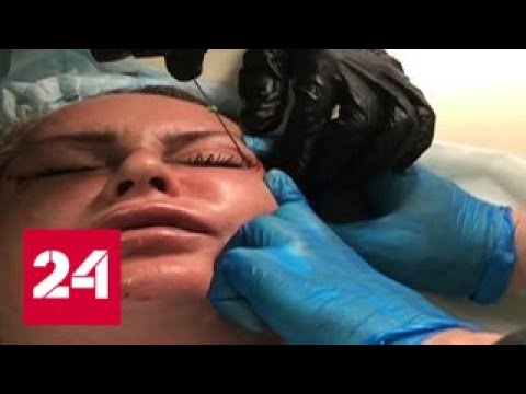 В пластические хирурги через соцсети: как не стать жертвой блогера-мошенника? — Россия 24