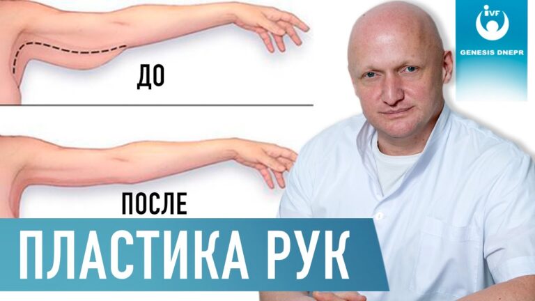 Пластика рук и плеча. Брахиопластика | Как делается пластика рук | Хирург высшей категории  Щевцов