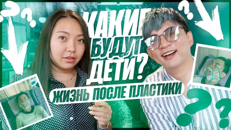 ЖАЛЕЕТ, что сделал? ПОСЛЕДСТВИЯ операции! Пластическая операция в КОРЕЕ |NikyMacAleen
