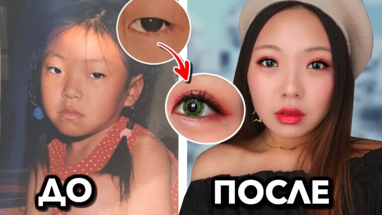 МОЯ ПЛАСТИЧЕСКАЯ ОПЕРАЦИЯ В 16 ЛЕТ! БЛЕФАРОПЛАСТИКА, ДВОЙНОЕ ВЕКО|NikyMacAleen