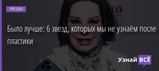 Было лучше: 6 звезд, которых мы не узнаём после пластики 19.05.2021