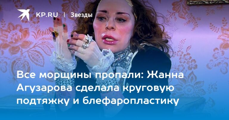 Жанна Агузарова сделала круговую подтяжку и блефаропластику Жанна Агузарова сделала круговую подтяжку и блефаропластику