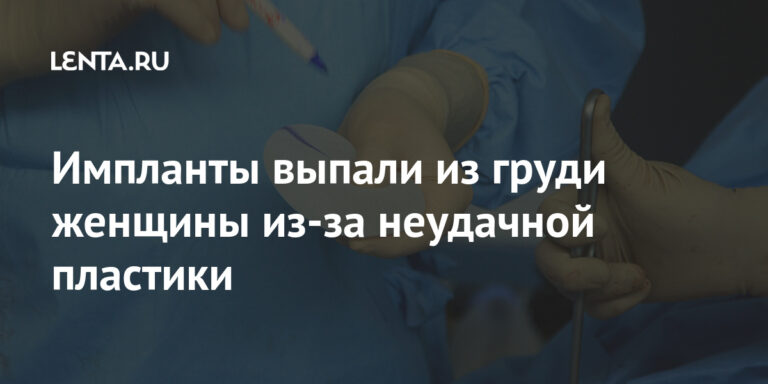 Импланты выпали из груди женщины из-за неудачной пластики: Внешний вид: Ценности: Lenta.ru Импланты выпали из груди женщины из-за неудачной пластики: Внешний вид: Ценности: Lenta.ru