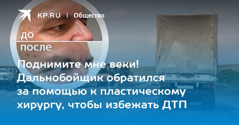 Поднимите мне веки! Дальнобойщик обратился за помощью к пластическому хирургу, чтобы избежать ДТП Поднимите мне веки! Дальнобойщик обратился за помощью к пластическому хирургу, чтобы избежать ДТП