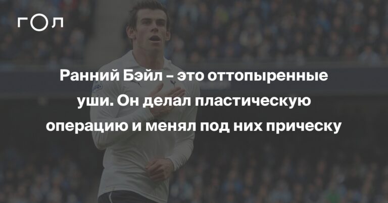 Ранний Бэйл – это оттопыренные уши. Он делал пластическую операцию и менял под них прическу Ранний Бэйл – это оттопыренные уши. Он делал пластическую операцию и менял под них прическу