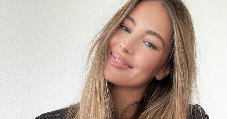 Удивительные побочные эффекты: вся правда о ботоксе | Журнал GRAZIA — Grazia