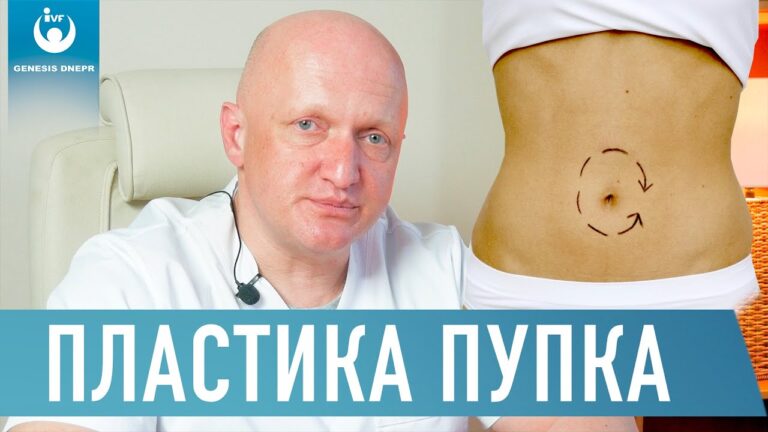 ПЛАСТИКА ПУПКА. Умбиликопластика. Лазерная хирургия | Хирург  высшей категории Щевцов А.Н.