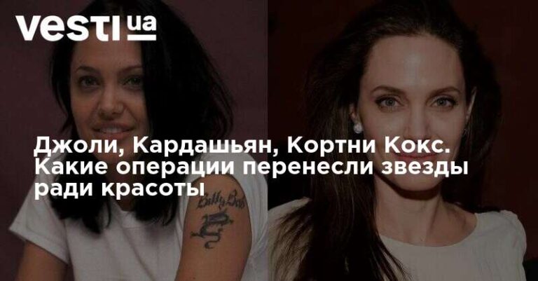 Джоли, Кардашьян, Кортни Кокс. Какие операции перенесли звезды ради красоты