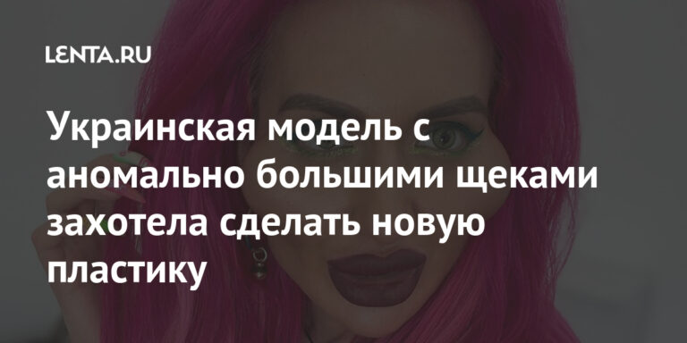 Украинская модель с аномально большими щеками захотела сделать новую пластику: Внешний вид: Ценности: Lenta.ru