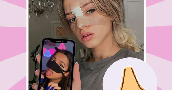 Юля Гаврилина, Tenderlybae и другие молодые звезды, которые переделали свои носы👃 Юля Гаврилина, Tenderlybae и другие молодые звезды, которые переделали свои носы👃