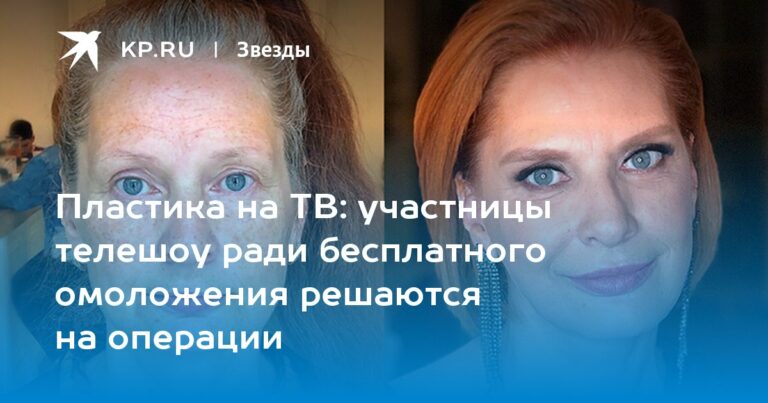 участницы телешоу ради бесплатного омоложения решаются на операции