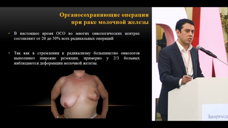 Реконструктивно-пластическая хирургия в комплексном лечении больных раком молочной железы
