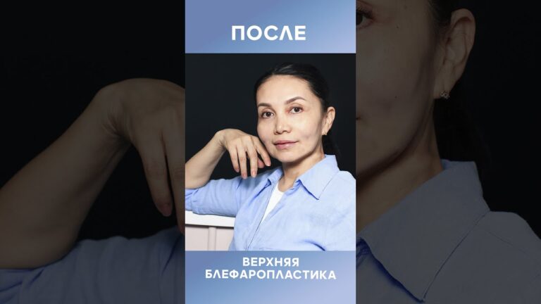 Какие проблемы решает круговая блефаропластика?