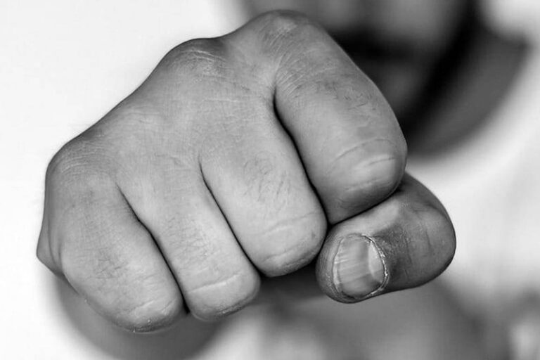 Минчанин после спора с незнакомцем в баре оказался в больнице Минчанин после спора с незнакомцем в баре оказался в больнице