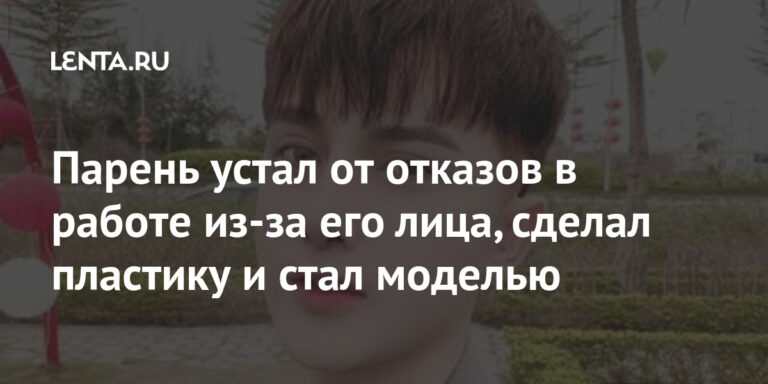 Парень устал от отказов в работе из-за его лица, сделал пластику и стал моделью: Внешний вид: Ценности: Lenta.ru Парень устал от отказов в работе из-за его лица, сделал пластику и стал моделью: Внешний вид: Ценности: Lenta.ru