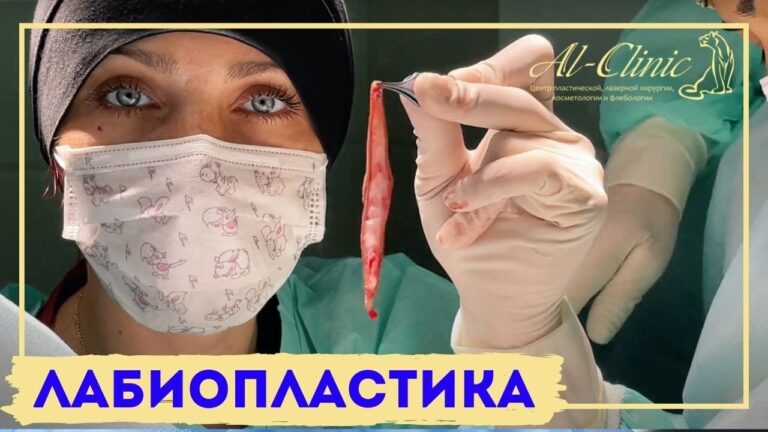 ЛАБИОПЛАСТИКА | УМЕНЬШЕНИЕ МАЛЫХ ПОЛОВЫХ ГУБ