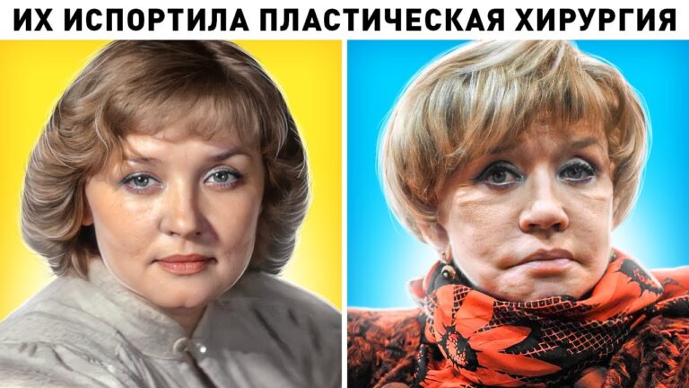 Жертвы пластики. 10 российских актрис, которых испортила пластическая хирургия