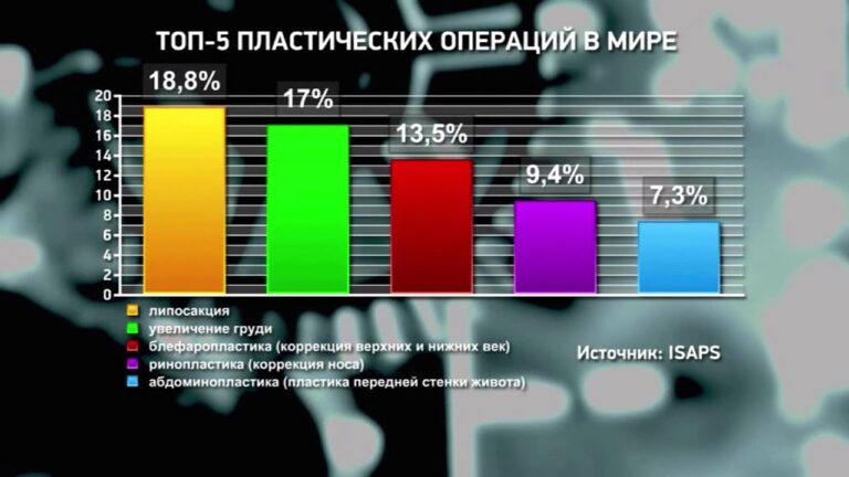 Пластическая хирургия. Мнение эксперта.