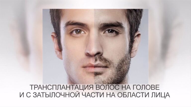 Пластическая хирургия у мужчин