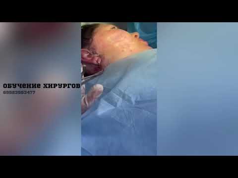 Удаление мезонитей, обучение пластическая хирургия