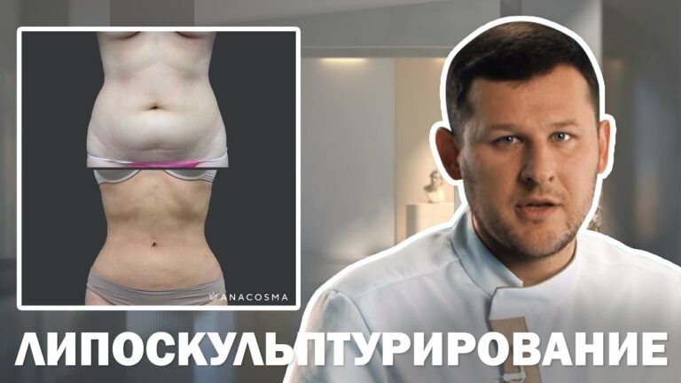 ЛИПОСКУЛЬПТУРИРОВАНИЕ 👀 ЛИПОМОДЕЛИРОВАНИЕ ТЕЛА 👀 ЧЕГО ОЖИДАТЬ⁉️
