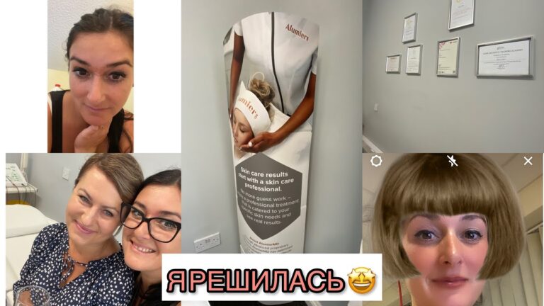 ПЛАСТИЧЕСКАЯ ХИРУРГИЯ ⁉️ Плазма Ручка❗️НАВОЖУ КРАСОТУ✔️Plasma blast treatment 🤩