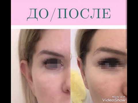 До и После пластических операций