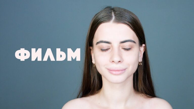 Ринопластика и ментопластика — комплекская коррекция профиля — до и после — Андрей Вылегжанин