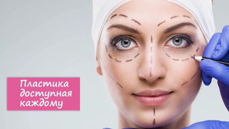 ПОЛНОЕ ПРЕОБРАЖЕНИЕ | ПЛАСТИКА | ПЛАСТИЧЕСКАЯ ХИРУРГИЯ / АБРИЕЛЛЬ