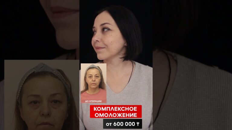 ПЛАСТИЧЕСКАЯ ХИРУРГИЯ. ОМОЛОЖЕНИЕ