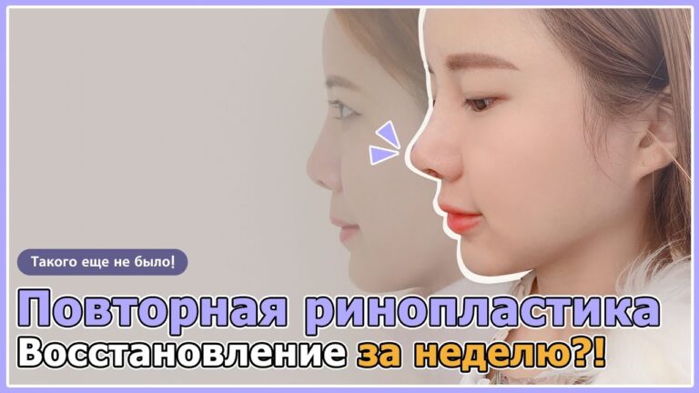 История преображения|Пластическая операция|Клиника пластической хирургии Гранд