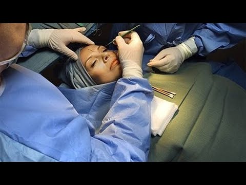 Пластическая хирургия. Когда пора и как не попасть в зависимость от зеркала?