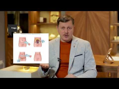 ТОП самых популярных пластических операций/ Пластический хирург Дмитрий Слоссер