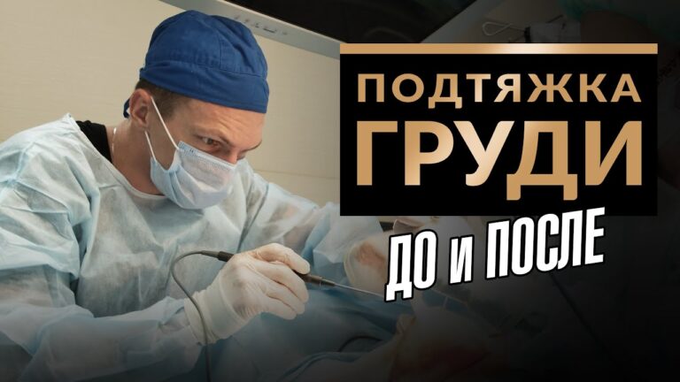 ПОДТЯЖКА ГРУДИ. До и после. Пластическая хирургия