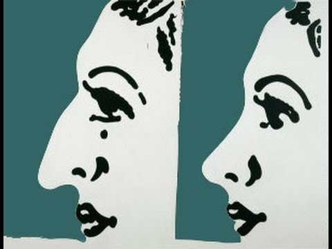 Ринопластика, Хуцидзе Зураб Вахтангович, пластика носа, пластическая хирургия
