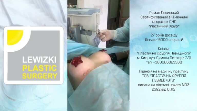Ендопротезування молочних залоз І Красиві груди І Збільшення грудей Центр пластичної хірургії м.Київ