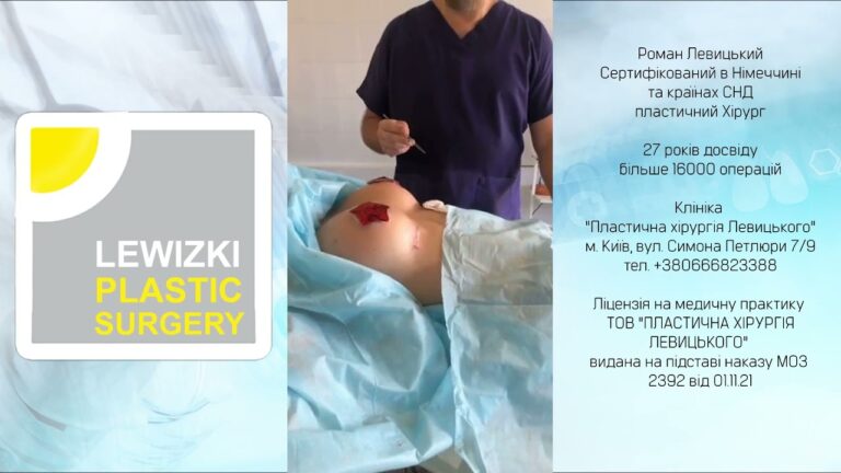 Ендопротезування молочних залоз І Красиві груди І Збільшення грудей Центр пластичної хірургії м.Київ