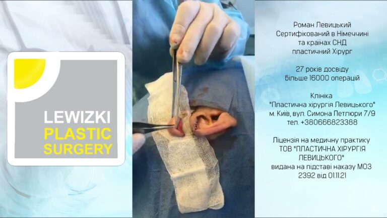 Отопластика І Пластика вух І Пластика вушних раковин І Центр пластичної хірургії м. Київ