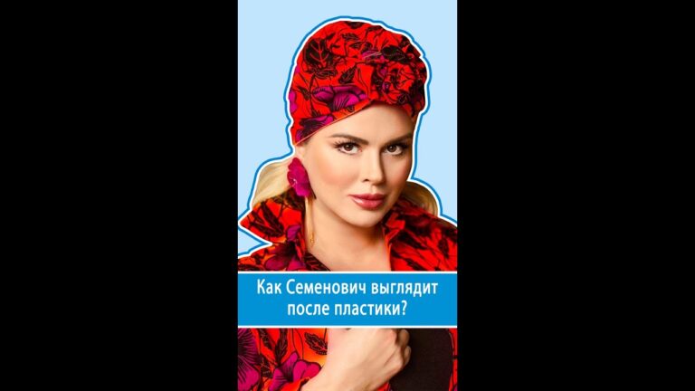 Коррекция проблемных зон: как Семенович выглядит после липосакции