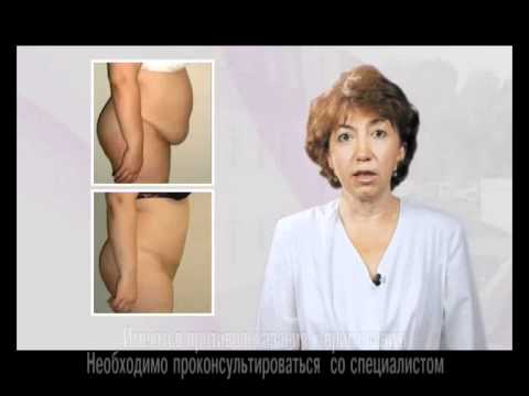 Пластическая хирургия