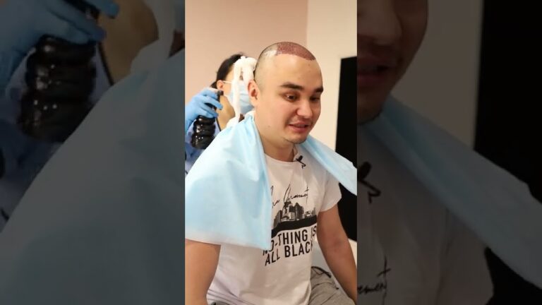 Трансплантация волос — это уникальная возможность иметь густую шевелюру вне зависимости от возраста.